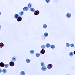 Formalin fixed paraffin embedded human adenovirus infected tissue stained with Adenovirus