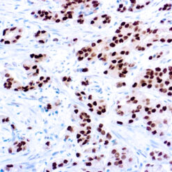 Formalin fixed paraffin embedded human prostate stained with Androgen Receptor