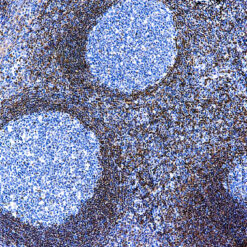 Formalin fixed paraffin embedded human tonsil stained with Bcl-2 Oncoprotein
