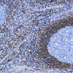 Formalin fixed paraffin embedded human tonsil stained with Bcl-2 Oncoprotein