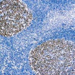 Formalin fixed paraffin embedded human tonsil stained with Bcl-6 antibody