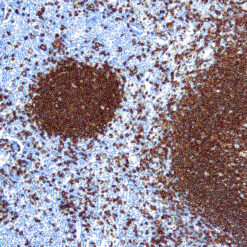 Formalin fixed paraffin embedded human tonsil stained with CD20