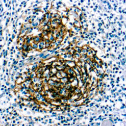 Formalin fixed paraffin embedded human tonsil stained with CD21