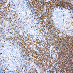 Formalin fixed paraffin embedded human Tonsil stained with CD3.