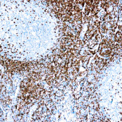 Formalin fixed paraffin embedded human tonsil stained with CD5