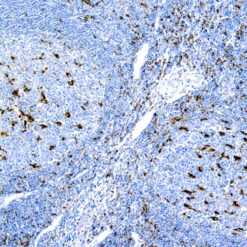Formalin fixed paraffin embedded human tonsil stained with CD68 Macrophage.