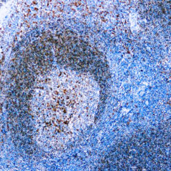 Formalin fixed paraffin embedded human tonsil stained with CD79a antibody.