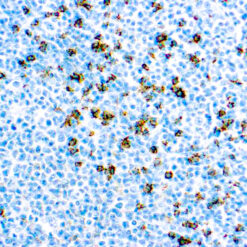 Formalin fixed paraffin embedded human tonsil stained with CD8