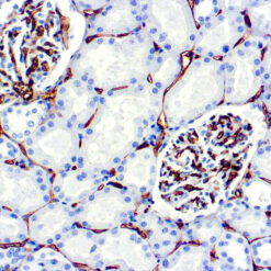 Formalin fixed paraffin embedded human kidney stained with CD34 antibody.