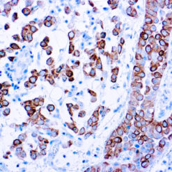 Formalin fixed paraffin embedded human colon stained with Cytokeratin 5.
