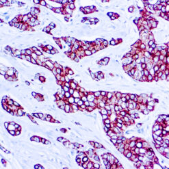 Formalin fixed paraffin embedded human breast tissue stained with Cam 5.2