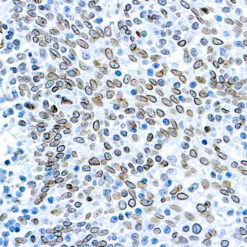 Formalin fixed paraffin embedded human tonsil stained with Cdc25A antibody