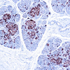 Formalin fixed paraffin embedded human pancreas stained with Chromogranin A antibody.