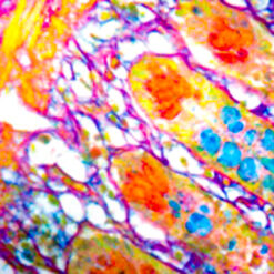 Human intestine stained with Colloidal Iron stain (KT007).