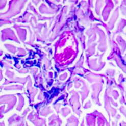 Combined Eosinophil-Mast Cell (KT004).