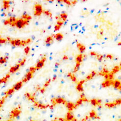 Copper Stain on copper deposits in Liver (KT033).