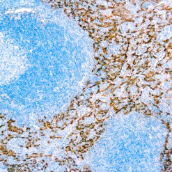 Formalin fixed paraffin embedded human tonsil stained with Cytokeratin 5/14.
