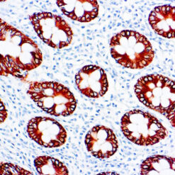 Formalin fixed paraffin embedded human colon stained with Cytokeratin 8 antibody