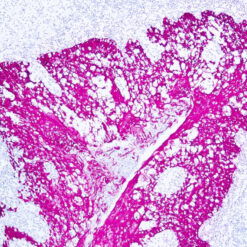 Formalin fixed paraffin embedded human tonsil stained with Cytokeratin HMW antibody.