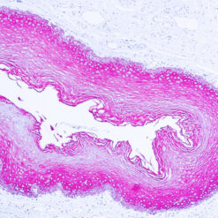 Formalin fixed paraffin embedded human skin stained with Cytokeratin Wide Spectrum antibody.