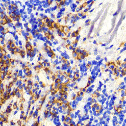 Formalin fixed paraffin embedded human tonsil stained with CD138.