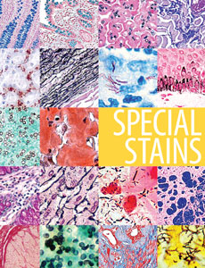 DBS SpecialStainsBrochure v4 web