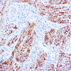 Formalin fixed paraffin embedded human uterus stained with Desmin antibody