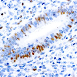 Formalin fixed paraffin embedded human uterus stained with E2F-1 Transcription Factor antibody.