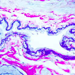 Human uterus stained with elastic stain (KT012)