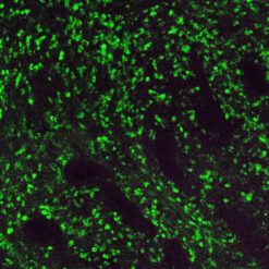 Formalin fixed paraffin embedded human tonsil stained with Kappa-FITC.