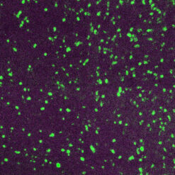 Formalin fixed paraffin embedded human tonsil stained with Lambda-FITC