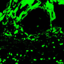 Formalin fixed paraffin embedded human liver stained with C3C Complement-FITC.