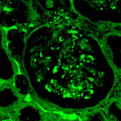 Formalin fixed paraffin embedded human kidney stained with C4C Complement-FITC.