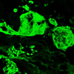 Formalin fixed paraffin embedded human placenta stained with Fibrinogen-FITC.