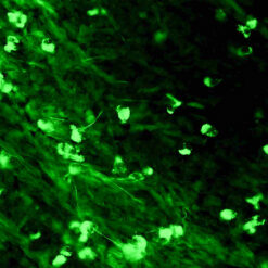 Formalin fixed paraffin embedded human tonsil stained with IgA-FITC.