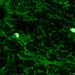 Formalin fixed paraffin embedded human tonsil stained with IgG-FITC.