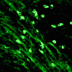 Formalin fixed paraffin embedded human tonsil stained with IgM-FITC.