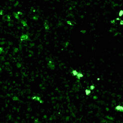 Formalin fixed paraffin embedded human spleen stained with C1q Complement-FITC