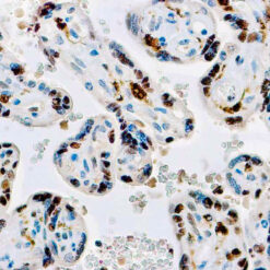 Formalin fixed paraffin embedded human placenta stained with Factor XIII-A antibody.