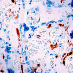 Formalin fixed paraffin embedded human placenta stained with Factor XIII-A antibody