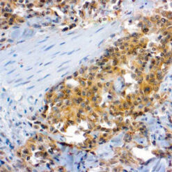 Formalin fixed paraffin embedded human skin stained with Flk-1 antibody