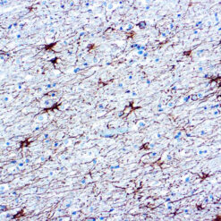Formalin fixed paraffin embedded human brain stained with GFAP antibody