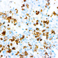Formalin fixed paraffin embedded human bladder stained with GLUT-1 antibody