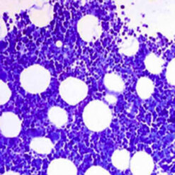 Human bone marrow stained with Giemsa kit (KT016).