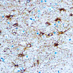 Formalin fixed paraffin embedded human brain stained with GFAP antibody.