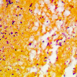 Graom positive and gram negative bacteria stained with Gram stain (KT018)