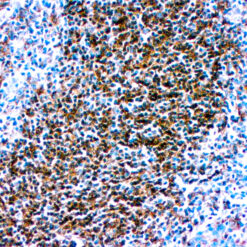 Formalin fixed paraffin embedded human tonsil stained with with HLA-DR antibody.