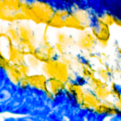 Human stomach stained with H. Pylori Rapid Stain (KT019)