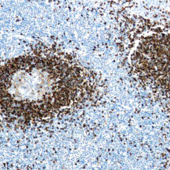 Formalin fixed paraffin embedded human tonsil stained with Hairy Cell Leukemia antibody.