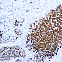 Formalin fixed paraffin embedded liver stained with Hepatocyte Specific Antigen antibody.